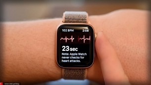 Χρήστης Apple Watch επέζησε χάρη στις ειδοποιήσεις για κολπική μαρμαρυγή (AFib) και στη συνέχεια διαγνώστηκε με διαβήτη.